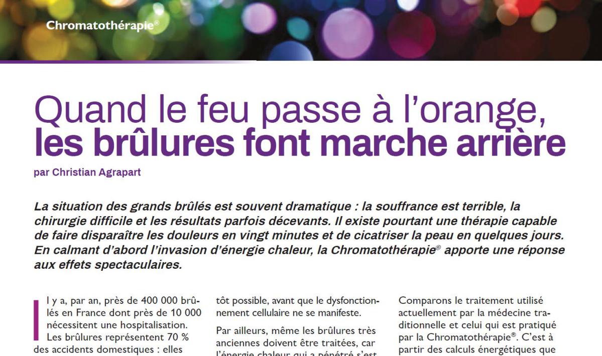 Article Christian Agrapart : Brûlures